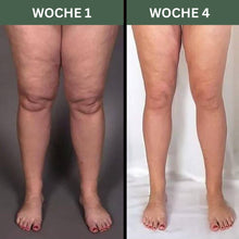 Lade das Bild in den Galerie-Viewer, Orthox Beinmassagegerät - Linderung von Ödemen und Krampfadern
